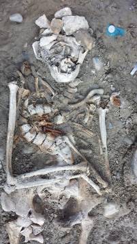 freigelegtes Skelett mit Skoliose der Wirbels&auml;ule (Landsberg am Lech, Foto Digit Company GbR)